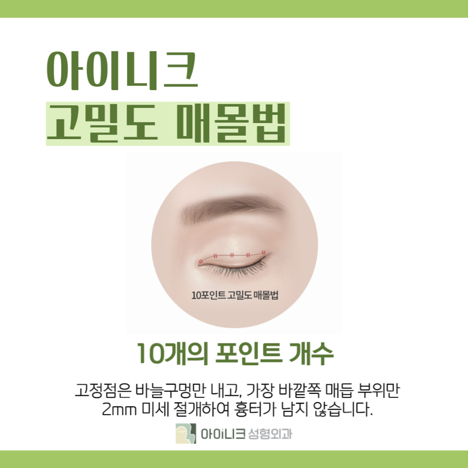 Beautifully, Without Worrying About Double Eyelid Surgery Scars image 5