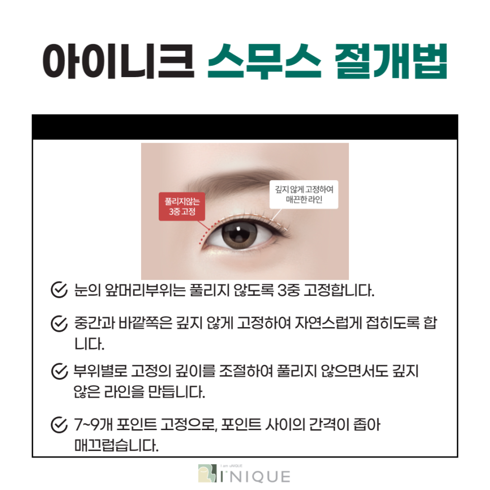 If You Want a Clear Change Before and After Double Eyelid Surgery image 4