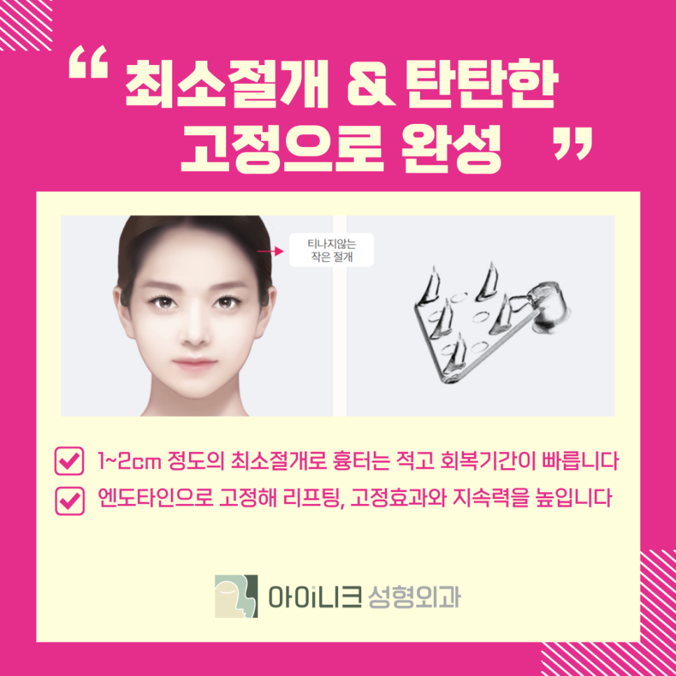 Why Is Brow Lift Surgery Needed in Apgujeong Eye Plastic Surgery? image 11