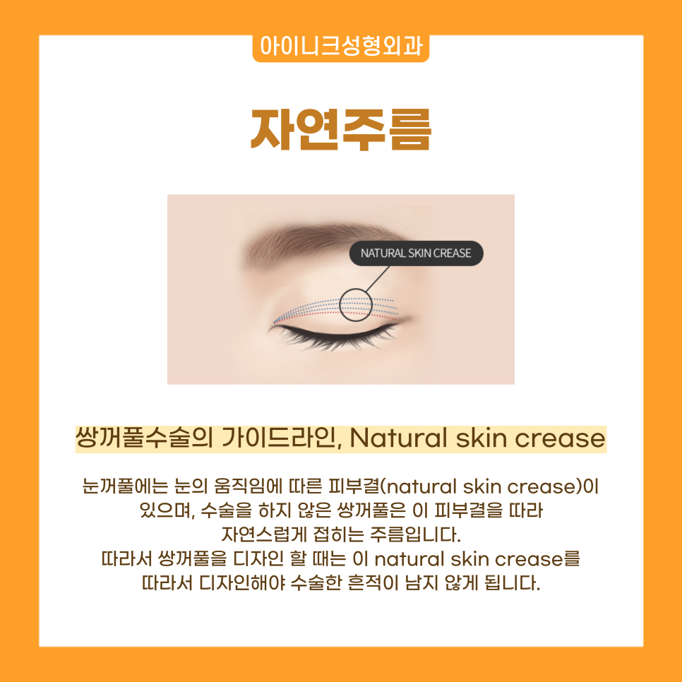 쌍수성형외과 자연스러움을 원한다면 눈성형전문 아이니크로 관련 이미지 6