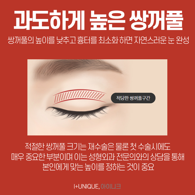 유명한 눈재수술명의를 찾고 있다면 아이니크성형외과로 관련 이미지 4