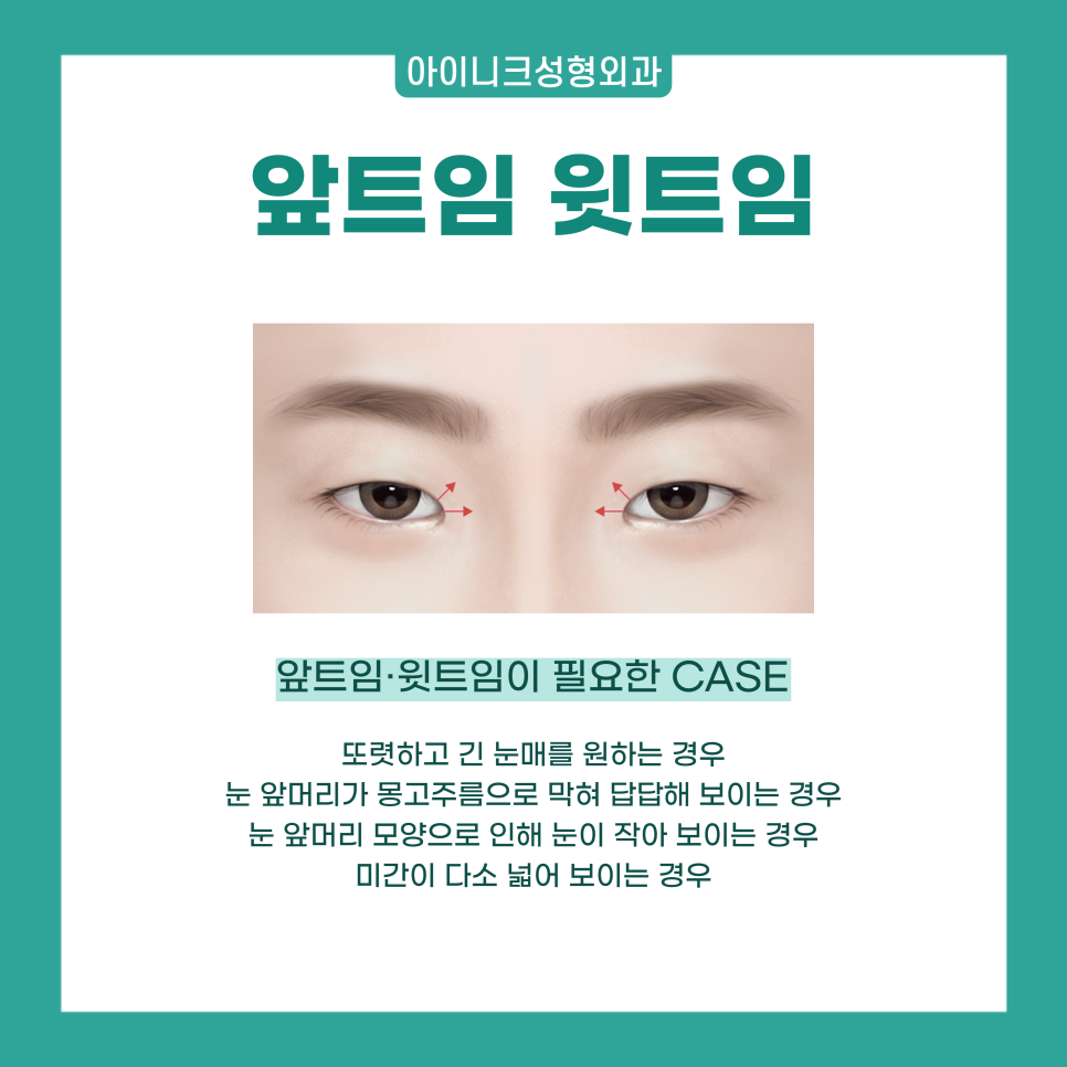 앞트임전후 확실한 인상의 변화를 원한다면 관련 이미지 5