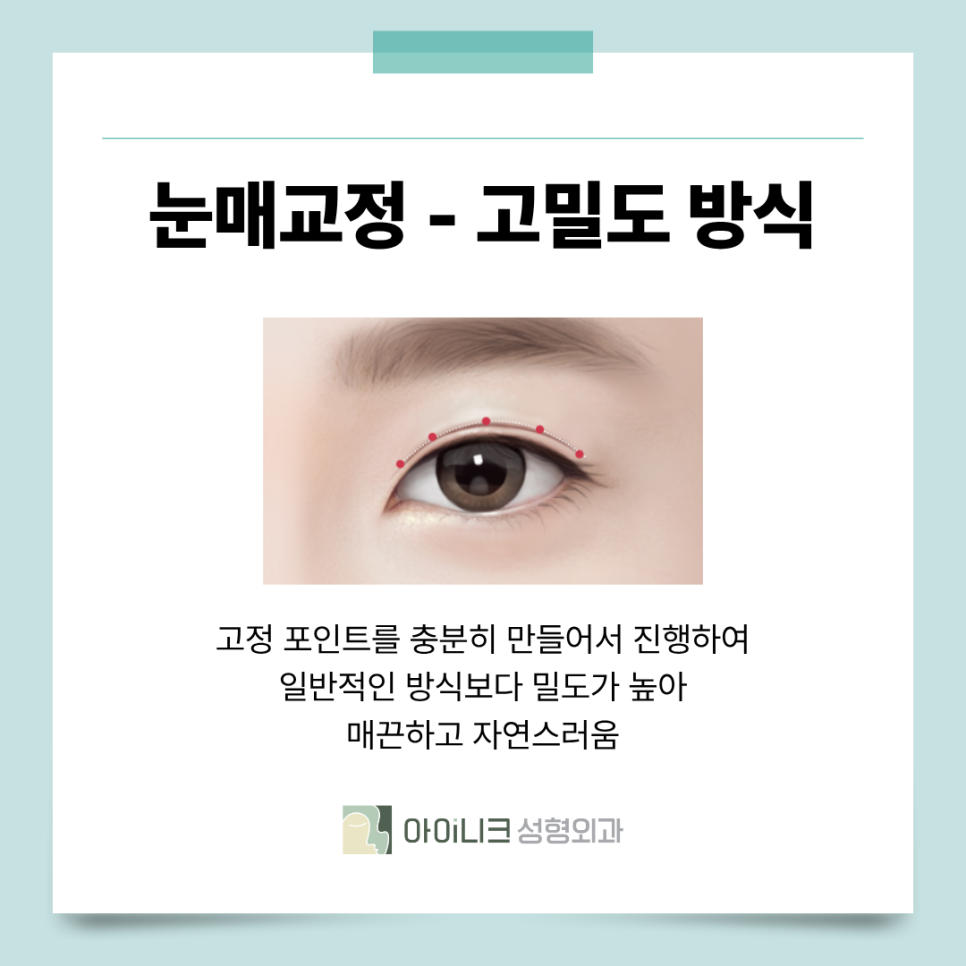 서울안검하수 눈꺼풀에 덮혀서 답답한 눈이라면? 관련 이미지 8