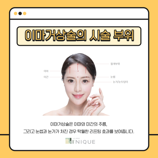 중년안면거상, 안전하게 하려면 관련 이미지 2