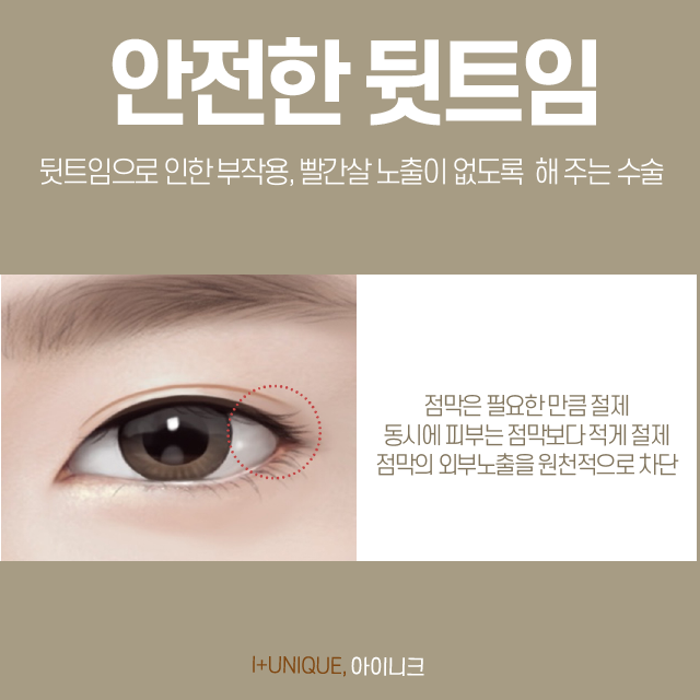 눈트임수술도 제대로 알고 가야 한다 바로 아이니크성형외과 처럼! 관련 이미지 4