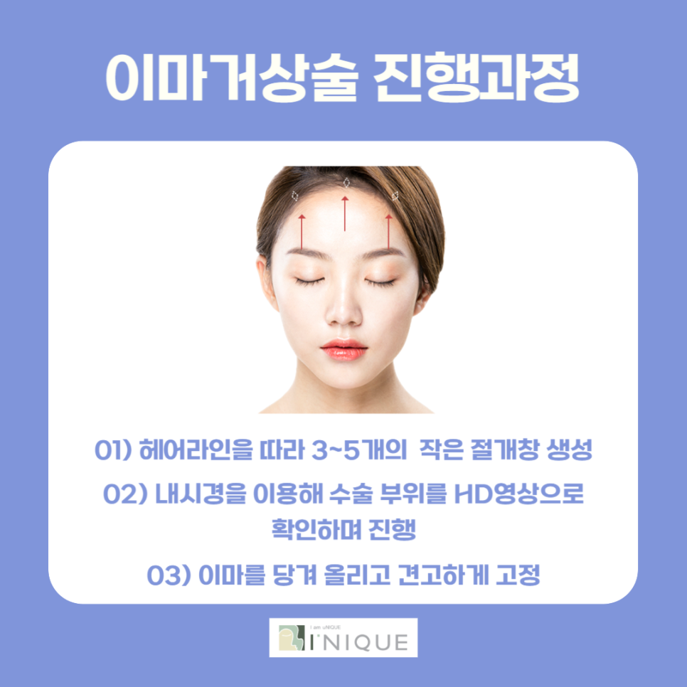눈처짐잘하는병원, 탄력과 생기를 동시에! 관련 이미지 4