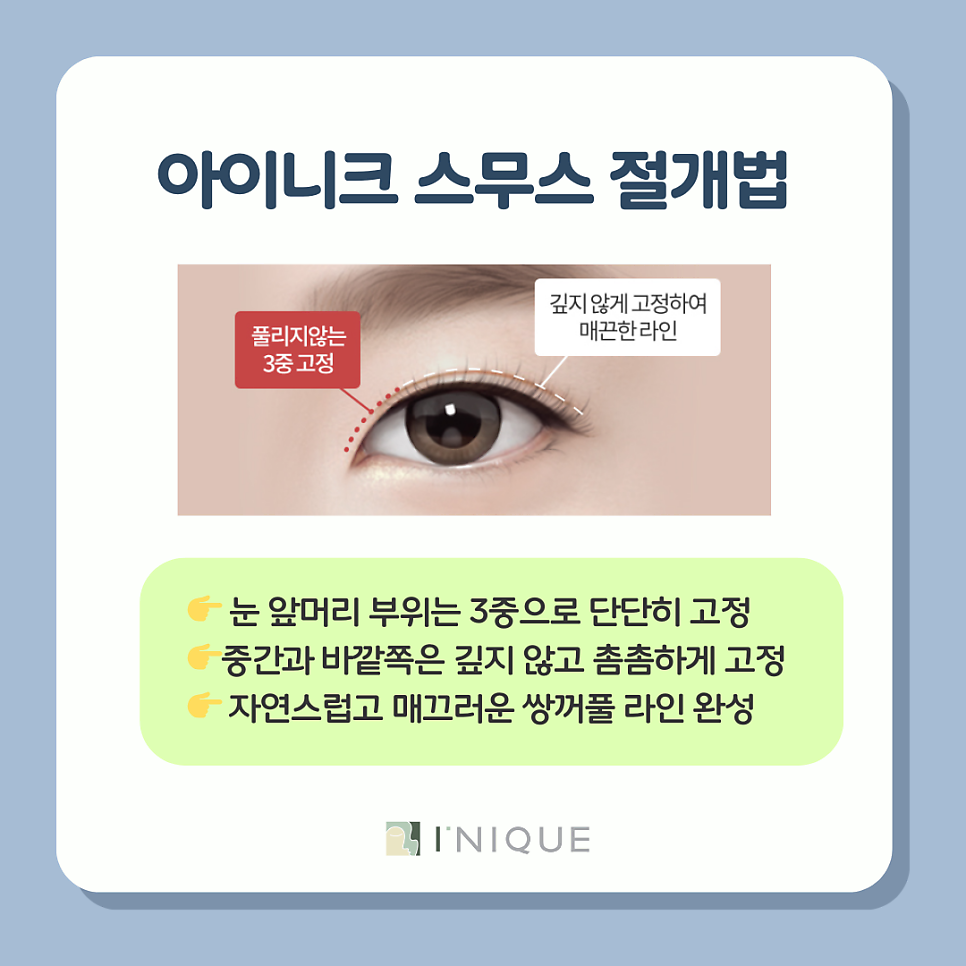 A Complete Guide to 4 Types of Eye Plastic Surgery in Gangnam! image 5