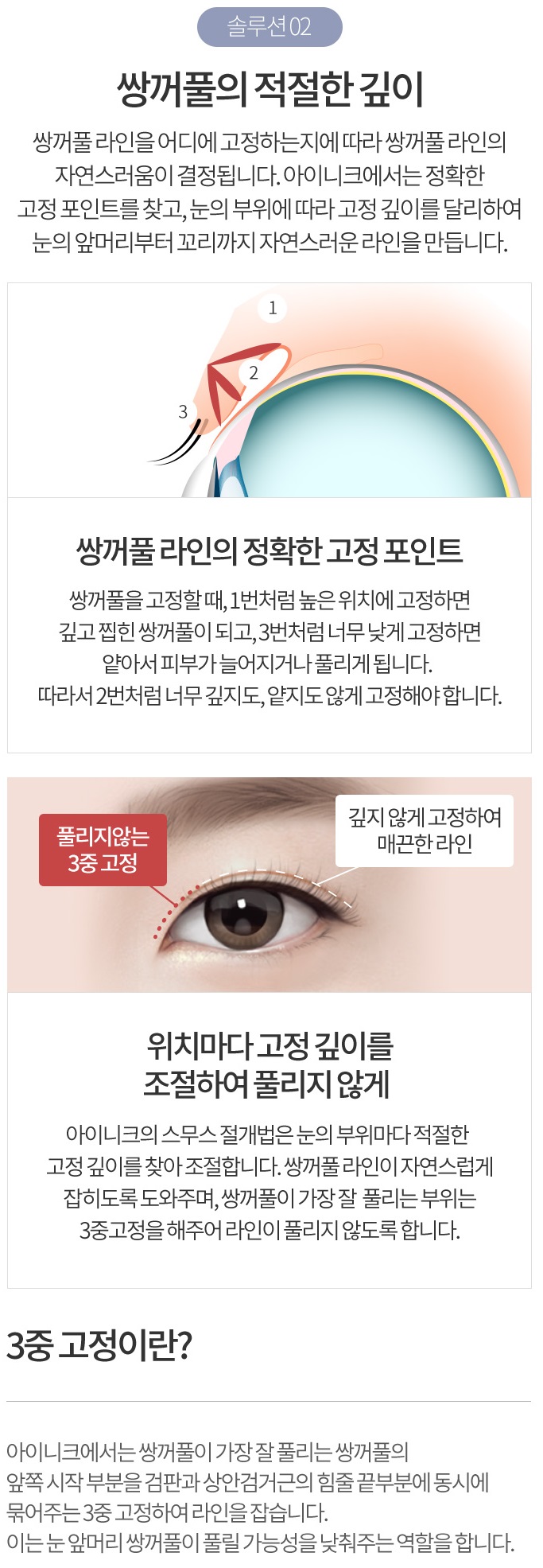 쌍수두께 병원 선택이 중요합니다! 관련 이미지 5