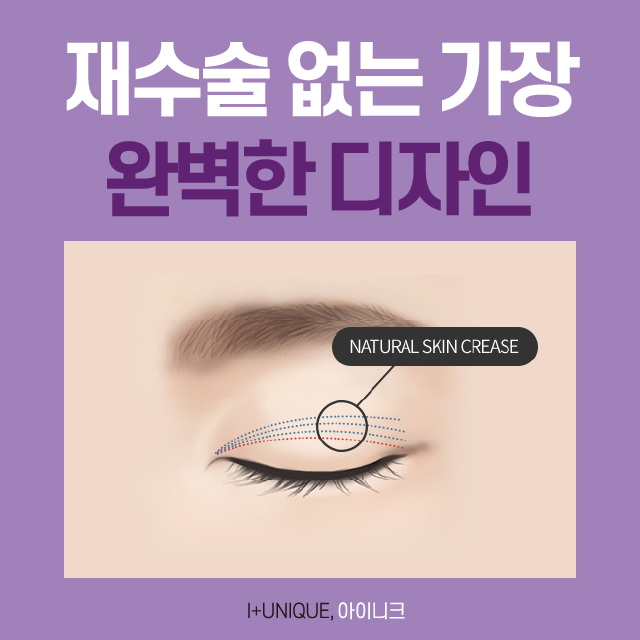 자연스러운쌍수를 위한 아이니크만의 솔루션 대공개 관련 이미지 5