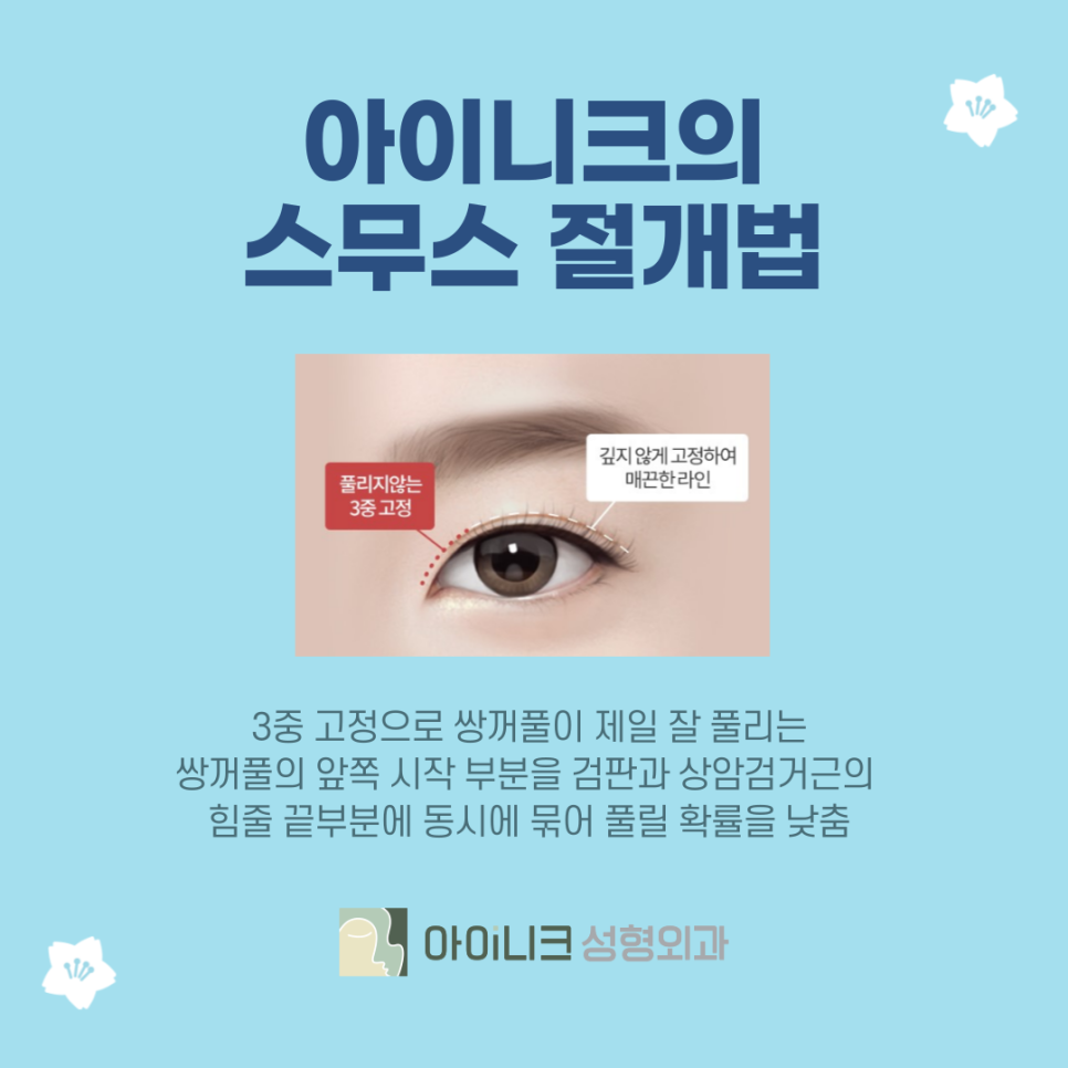 쌍수잘하는병원 잘 선택하는 기준은? 관련 이미지 7