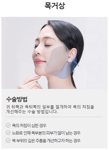 안면거상술비용 만족하실 수 있습니다. 관련 이미지 5