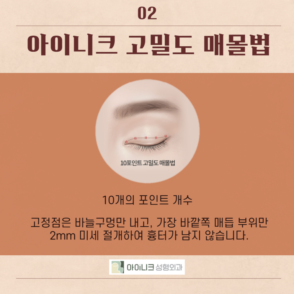 강남눈수술, 이곳이 답! 관련 이미지 4
