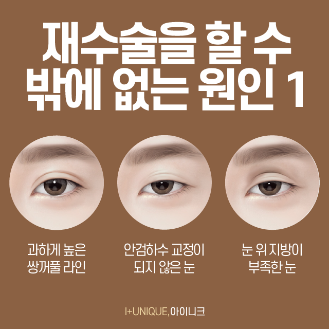 If you’re worried about uneven eyes after eye surgery, Ineek’s one-sided revision surgery is the answer! image 2