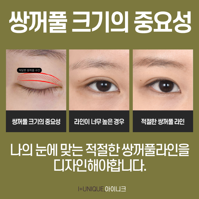 If You Want to Succeed with Gangnam Eye Surgery on Your First Operation? image 3
