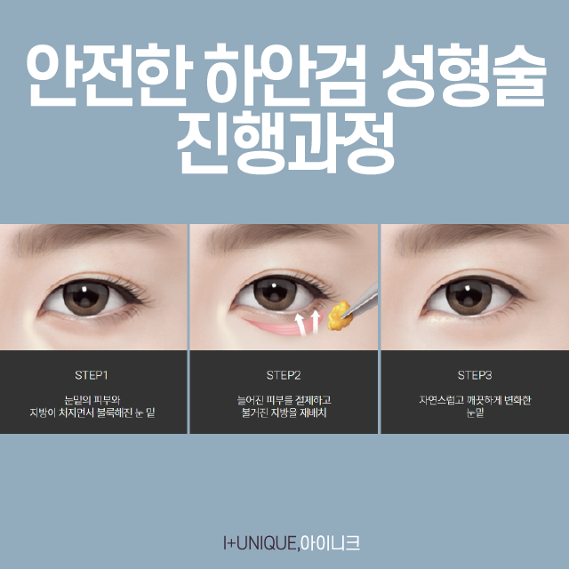The Most Important Key Point for Successful Middle-Age Eye Surgery image 5