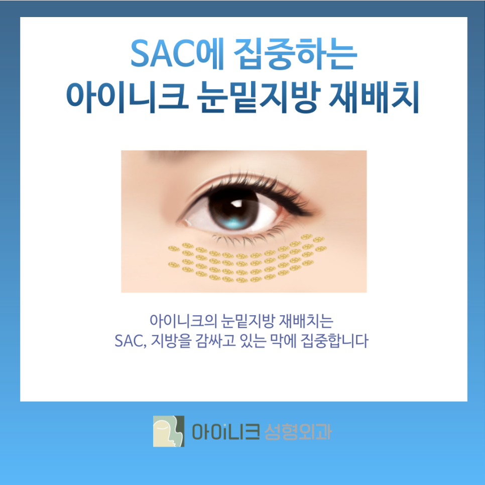 눈밑지방재배치효과 앙코르 눈밑센터에서 개선하기 관련 이미지 5