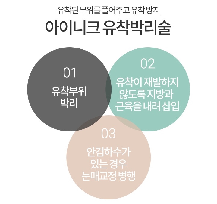 눈꺼풀지방이식비용 자연스러운 눈매로 변신 관련 이미지 7