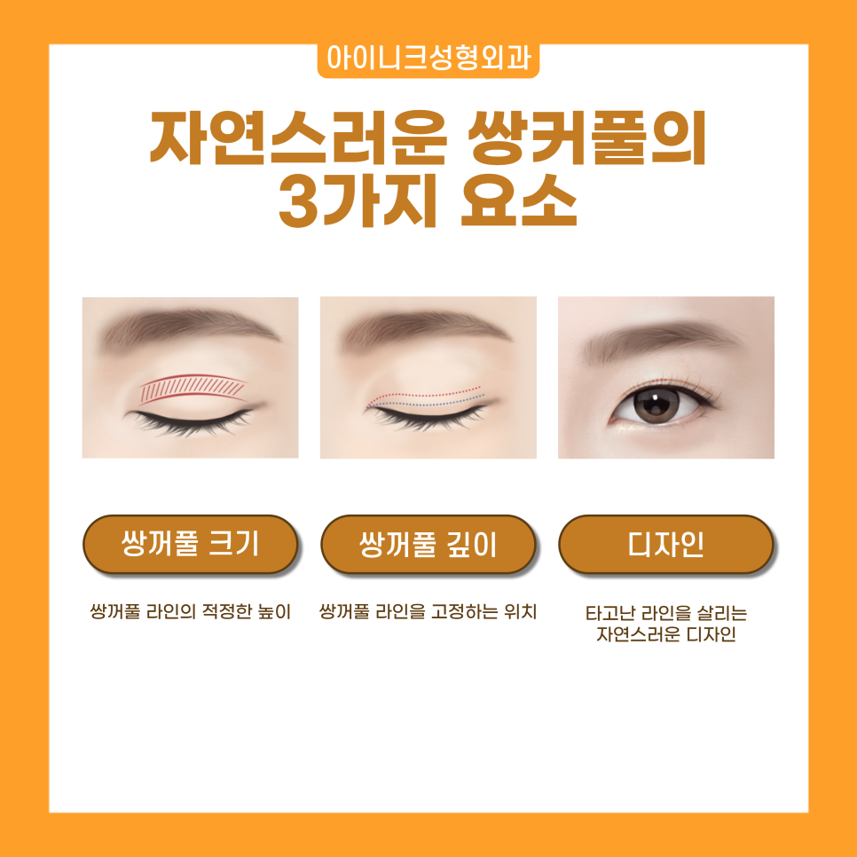 쌍수성형외과 자연스러움을 원한다면 눈성형전문 아이니크로 관련 이미지 2