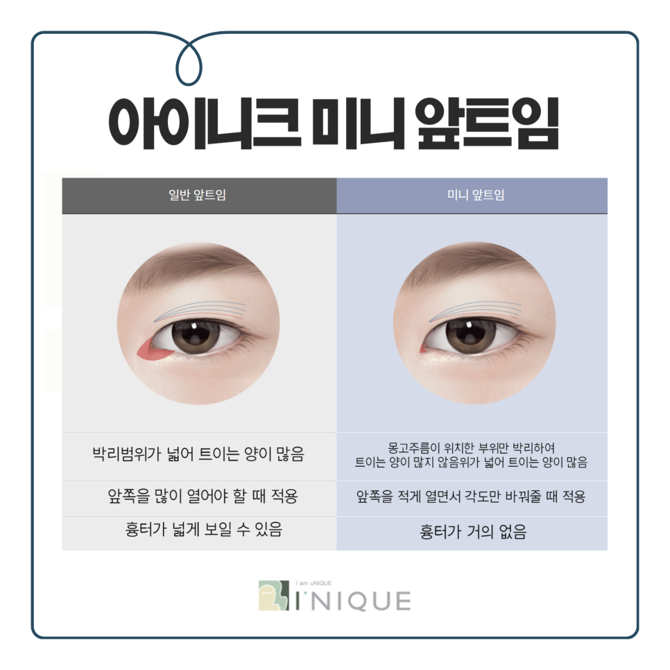 뒤트임잘하는곳 만의 특별함 관련 이미지 3