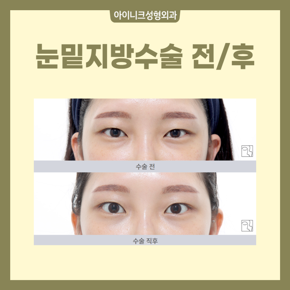 A New Concept in Under-Eye Surgery Center, Inique! image 4