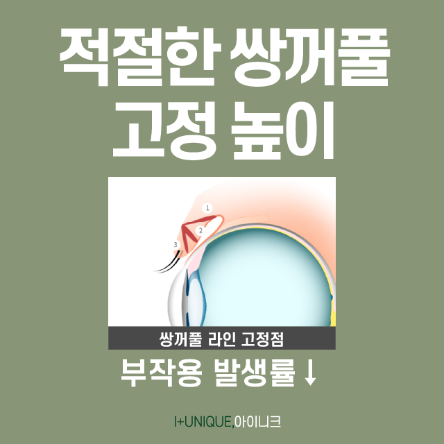 쌍꺼풀수술 흉터, 아이니크가 책임질게! 관련 이미지 4