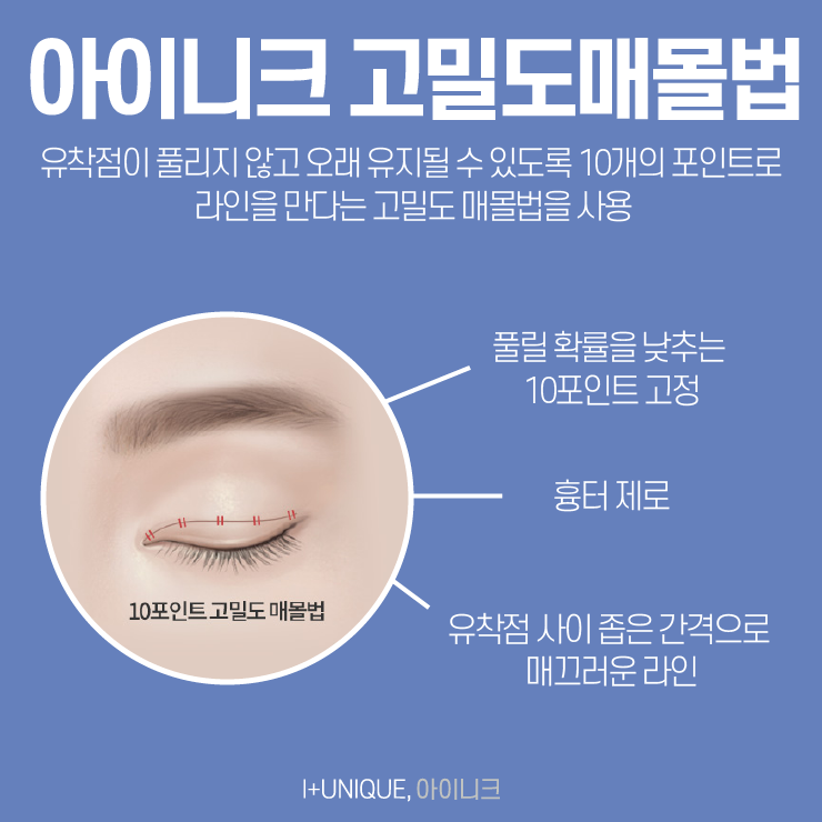 쌍커풀수술병원 첫 수술이니까 신중하게 아이니크성형외과에서 관련 이미지 4