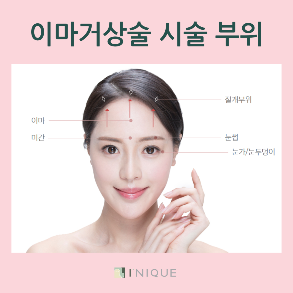 압구정이마거상잘하는곳 찾고있나요 관련 이미지 4