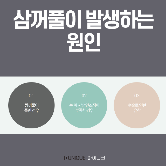 쌍꺼풀 여러겹 해결하고 싶다면? 관련 이미지 2