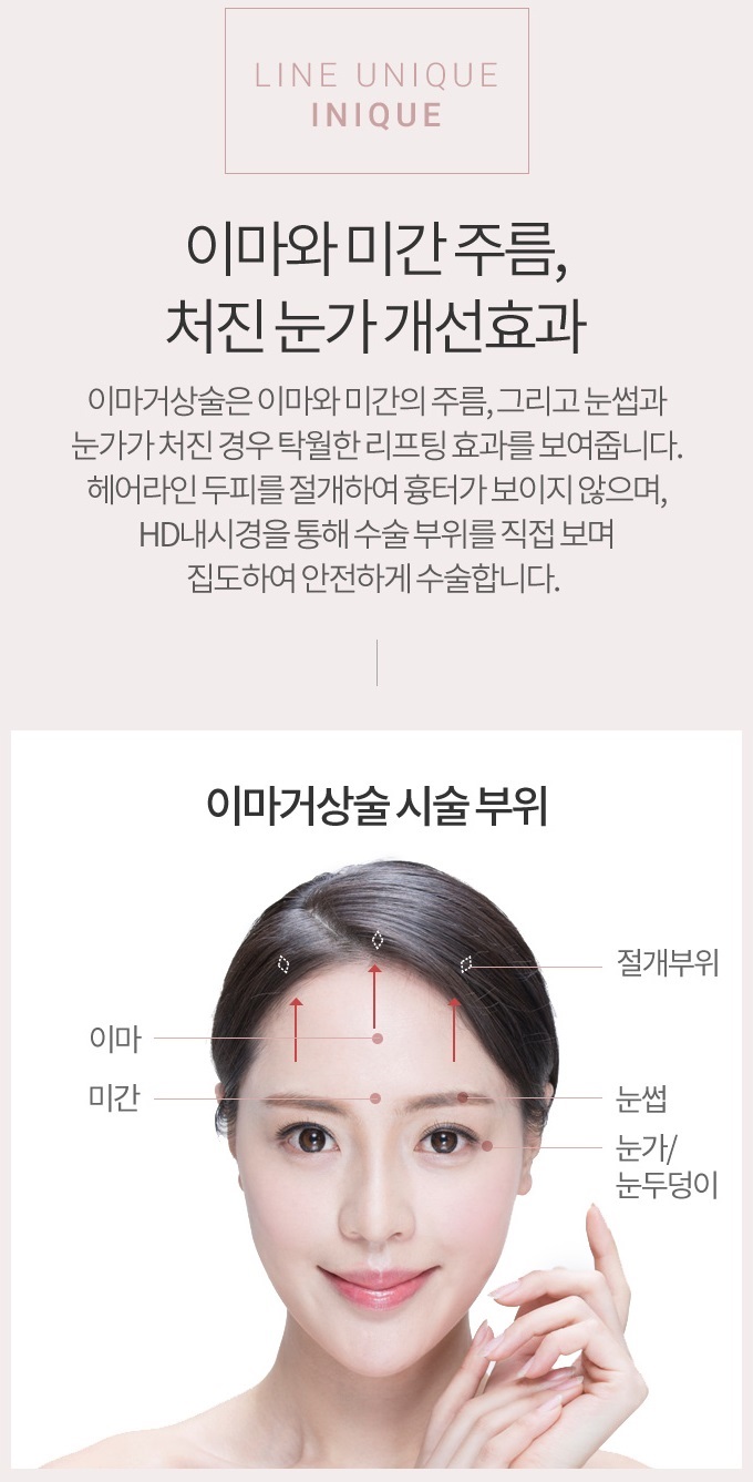 내시경이마거상으로 리프팅 효과까지! 관련 이미지 2
