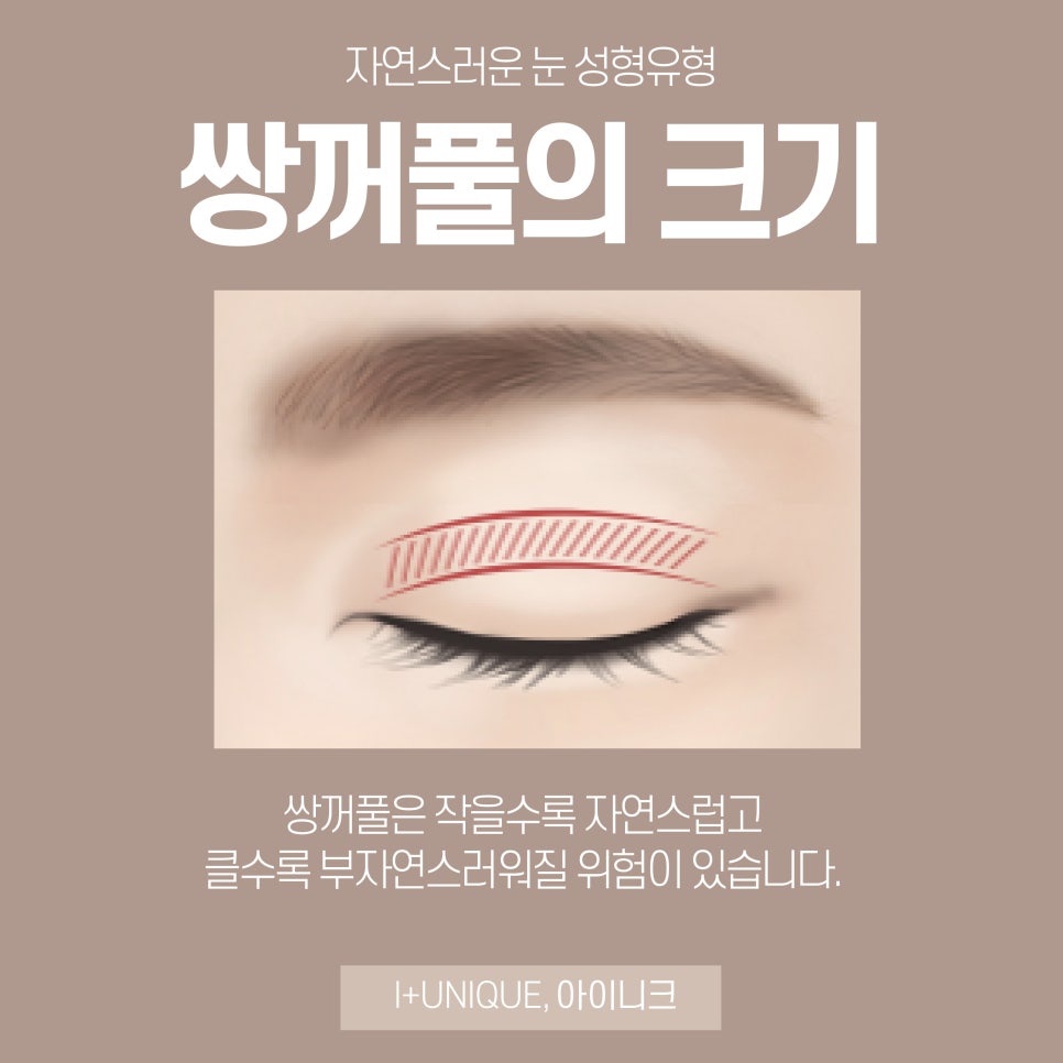 쌍꺼풀수술병원 믿을 수 있는 선택, 아이니크성형외과 관련 이미지 3