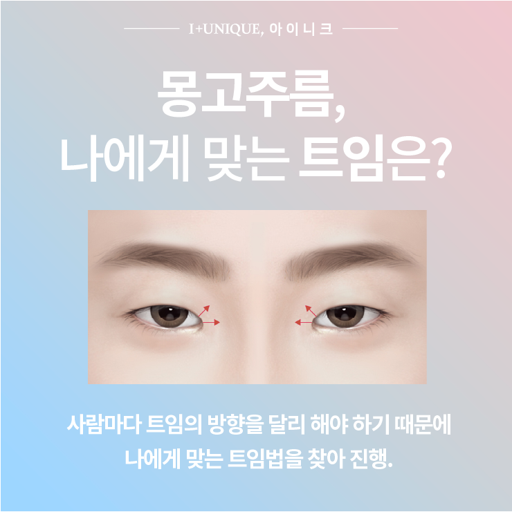 답답해 보이는 눈을 시원하게 트임! ㅇㅇㄴㅋ성형외과 관련 이미지 3