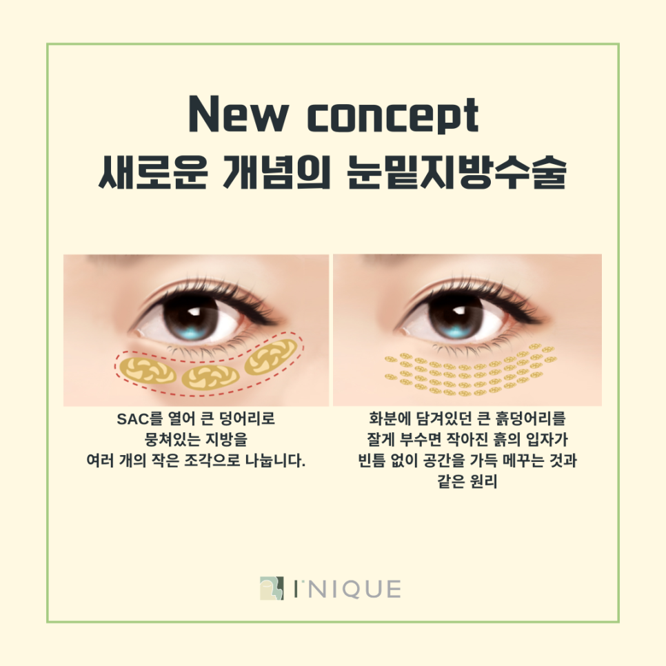 Solving Under-Eye Fat with Encore Laser image 5