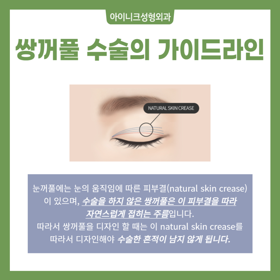 How to Make Your Eyes Look Bigger, This Is the Sure Way! image 5