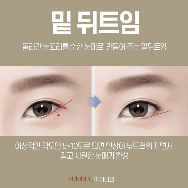 눈트임수술도 제대로 알고 가야 한다 바로 아이니크성형외과 처럼! 관련 이미지 5