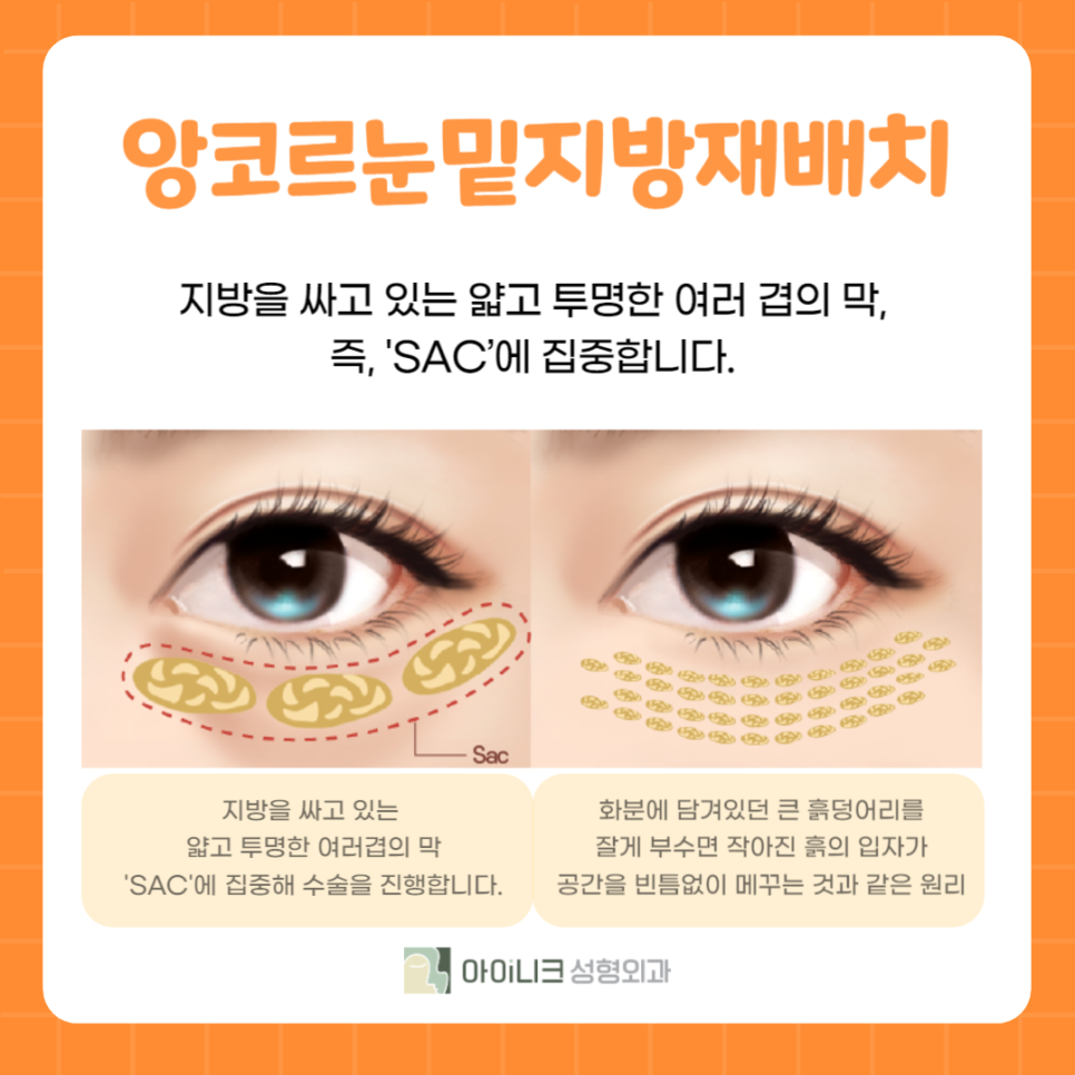The Difference of Ainic’s Encore Under-Eye Fat Repositioning image 2