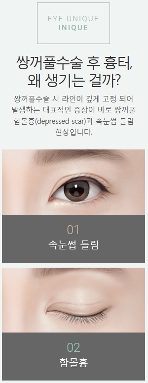 속눈썹들림 쌍수 후 흉터 개선 방법은? 관련 이미지 2