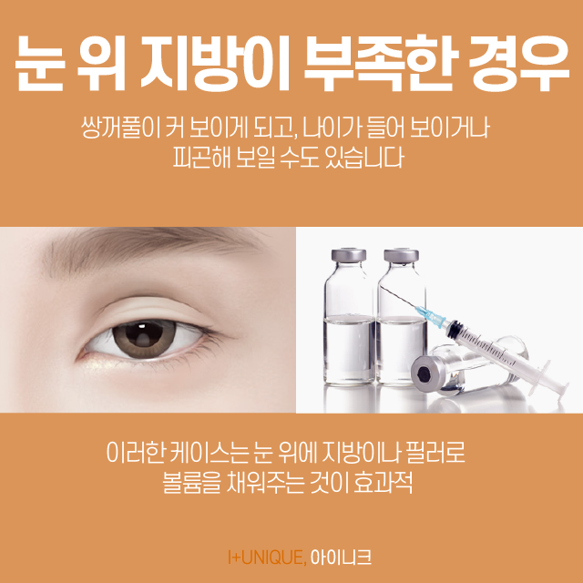 쌍꺼풀재수술병원 알아보고 있다면 경험많은 곳을 선택해야죠 관련 이미지 5
