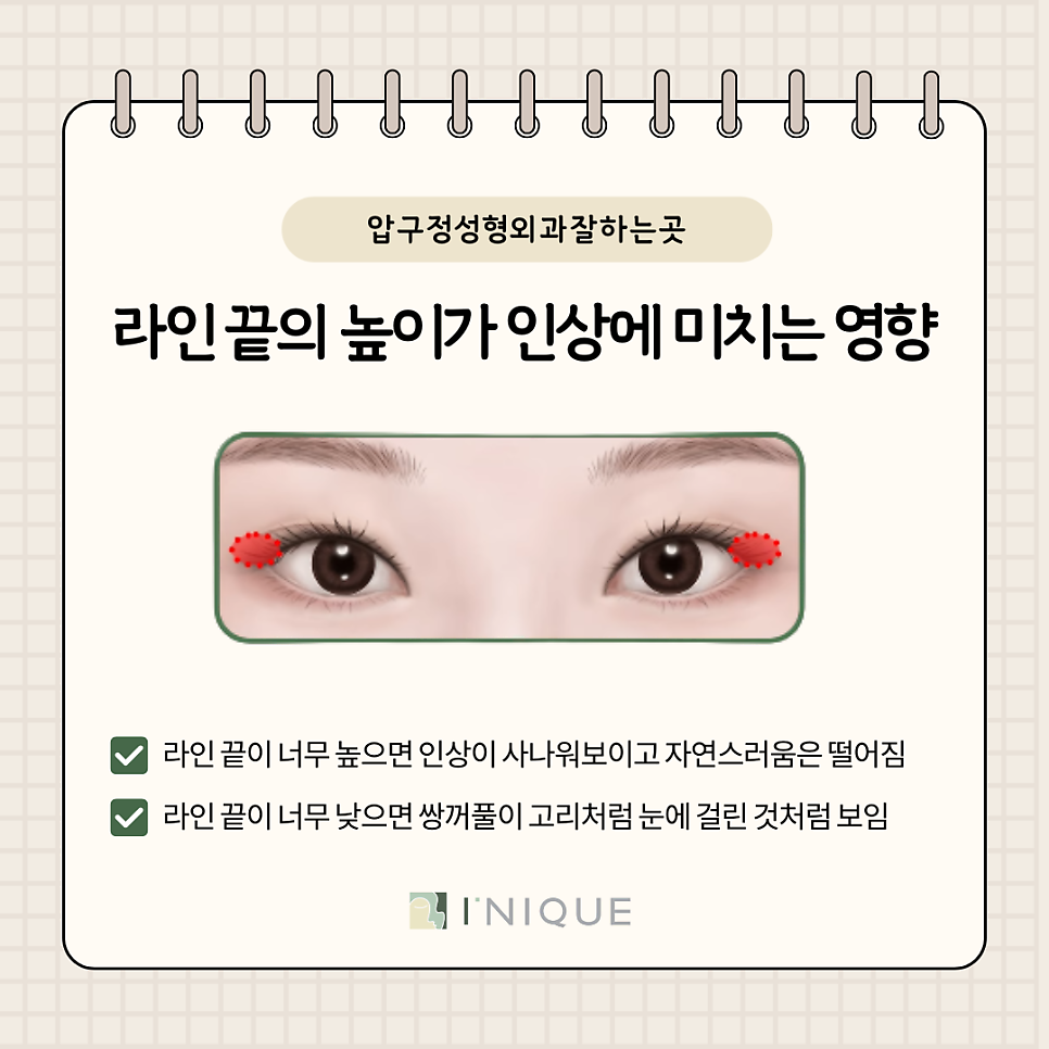 The Secret of Double Eyelid Height Revealed by a Best-Rated Apgujeong Plastic Surgery Clinic image 7