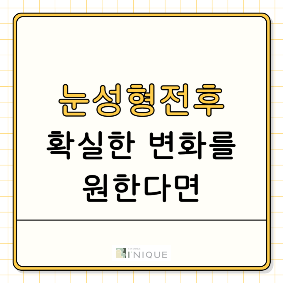 눈성형전후 확실한 변화를 원한다면 관련 이미지 1