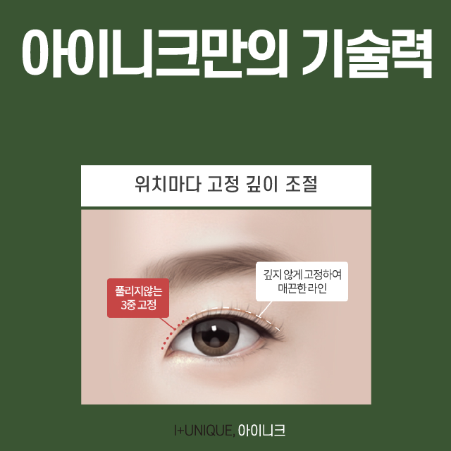 First Double-Eyelid Surgery: Know This and Nothing Else Before You Do It! image 4