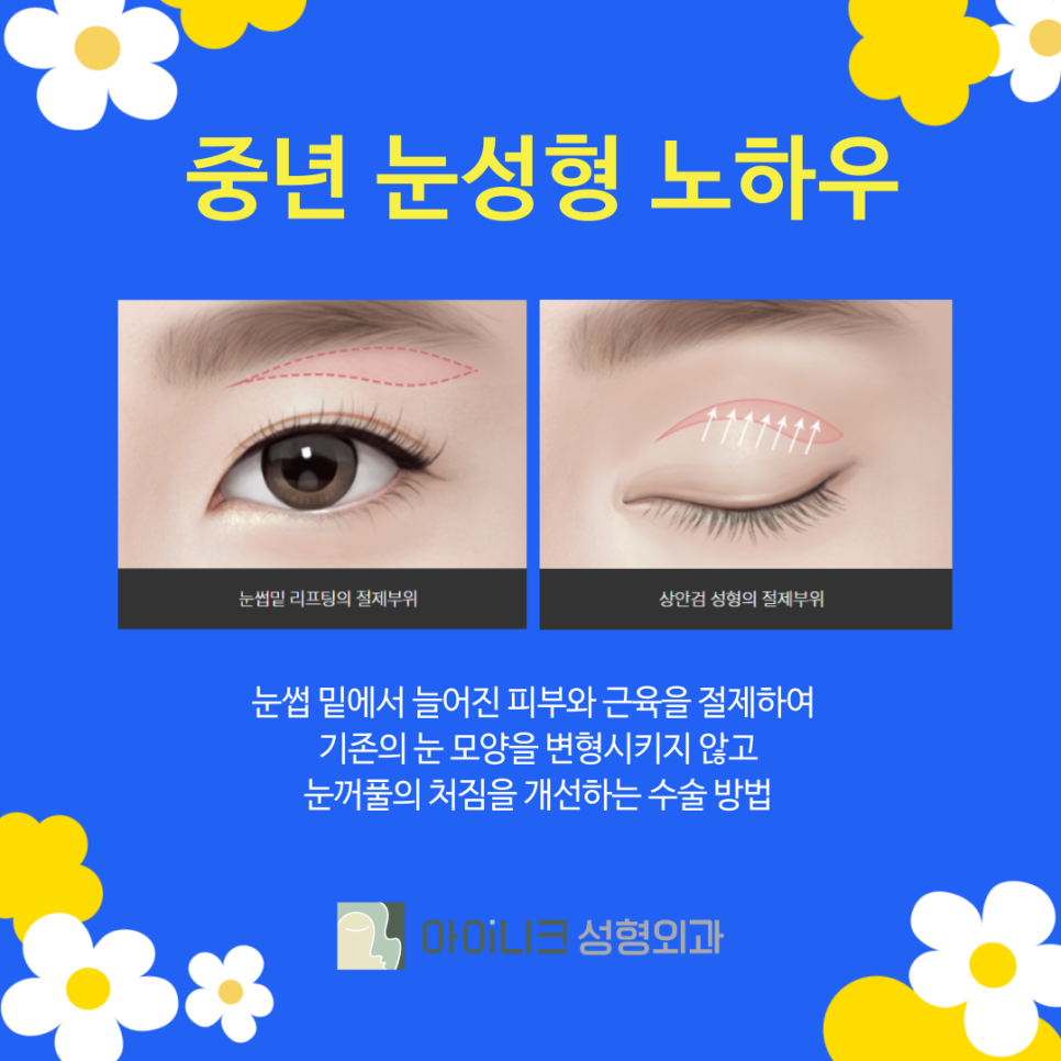 A filial cosmetic procedure to help your mother regain her youth image 7