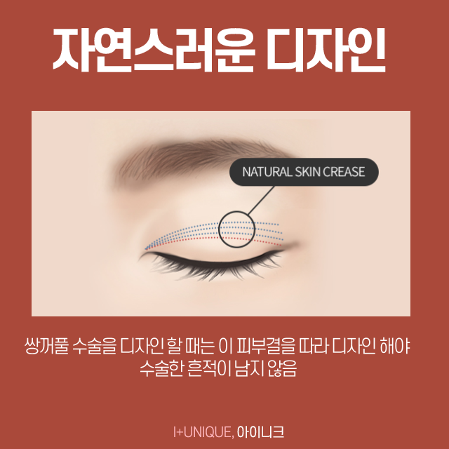 쌍꺼풀잘하는곳에는 다 방법이 있다, 어떤 것이 있을까 관련 이미지 5
