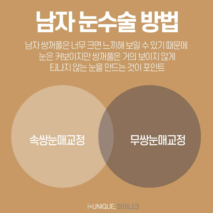 나에게 가장 잘 맞는 눈성형종류 어떤게 있을까 관련 이미지 5