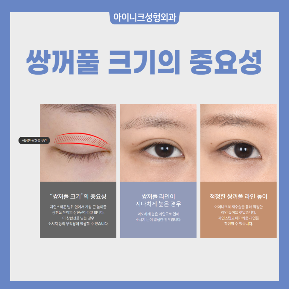 Male Eye Surgery Clinic: Natural and Refined Eye Shape image 3