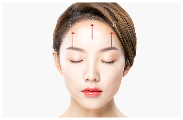 눈썹거상술 필요하신가요? 관련 이미지 5