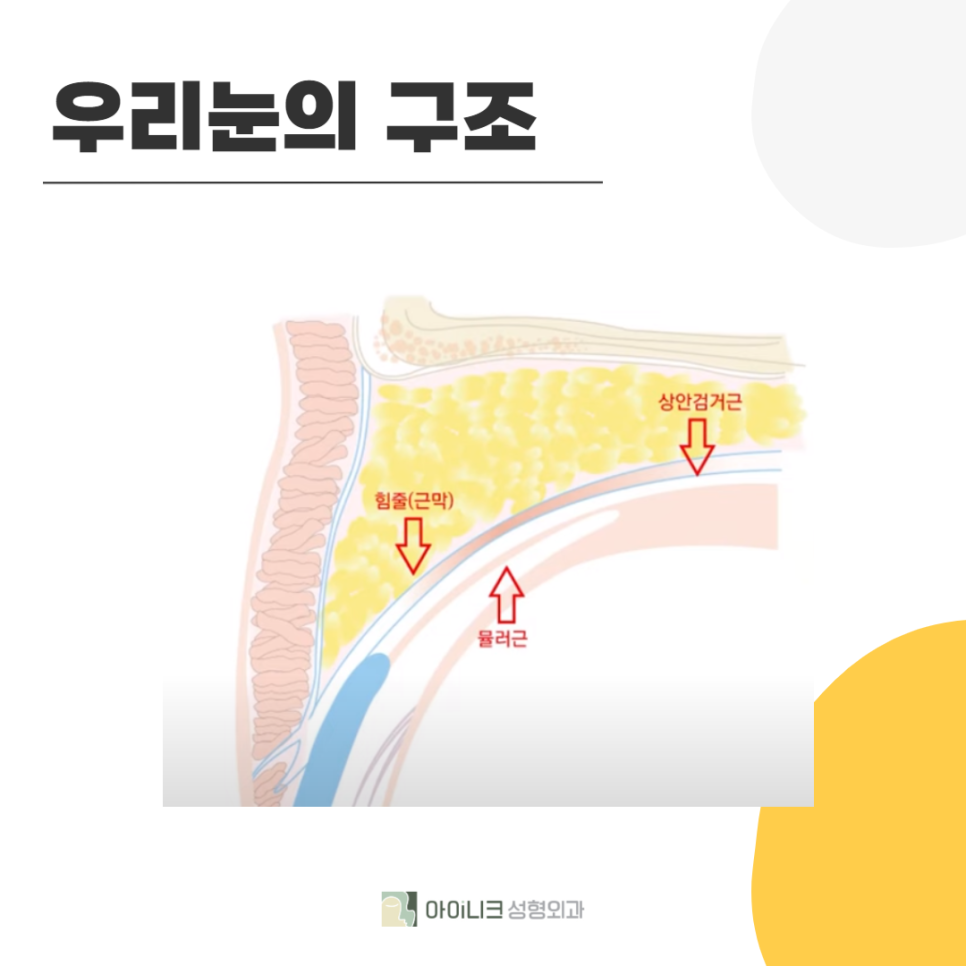 처진눈꺼풀개선이 필요하다면 주목! 관련 이미지 3
