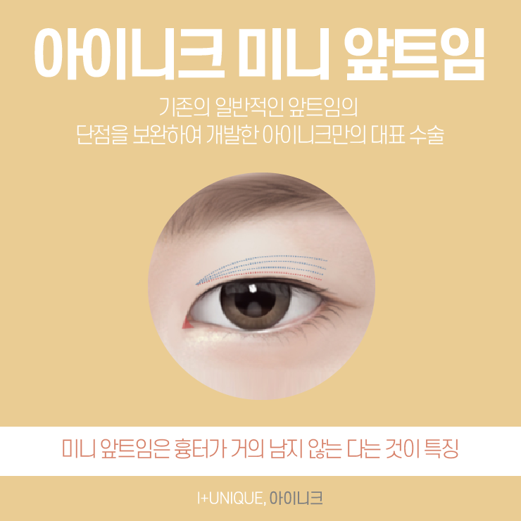 앞트임잘하는곳은 바로 여기! 아이니크성형외과 관련 이미지 4