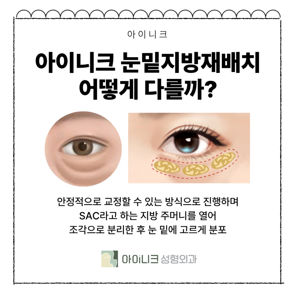 What Is the Appropriate Age for Under-Eye Fat Repositioning Surgery? image 4
