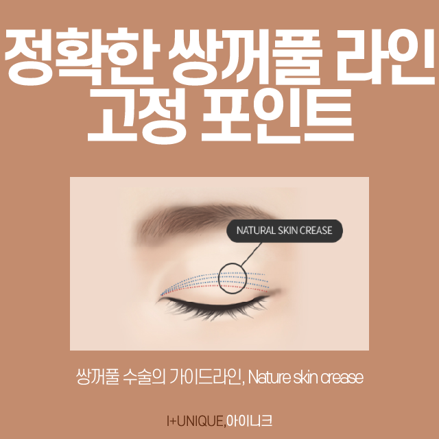 Ptosis and Eyelash Lift-Up: No More Stress! image 3