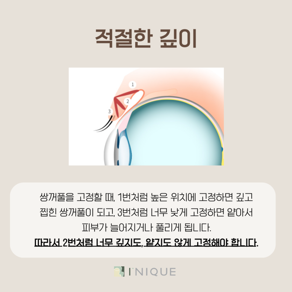 If You’re Looking for a Clinic That’s Good at Eye Surgery image 4